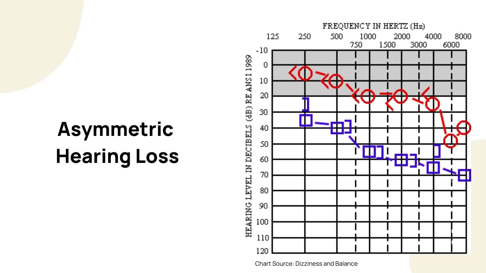 How To Read An Audiogram | Dr. Amy Sarow Explains