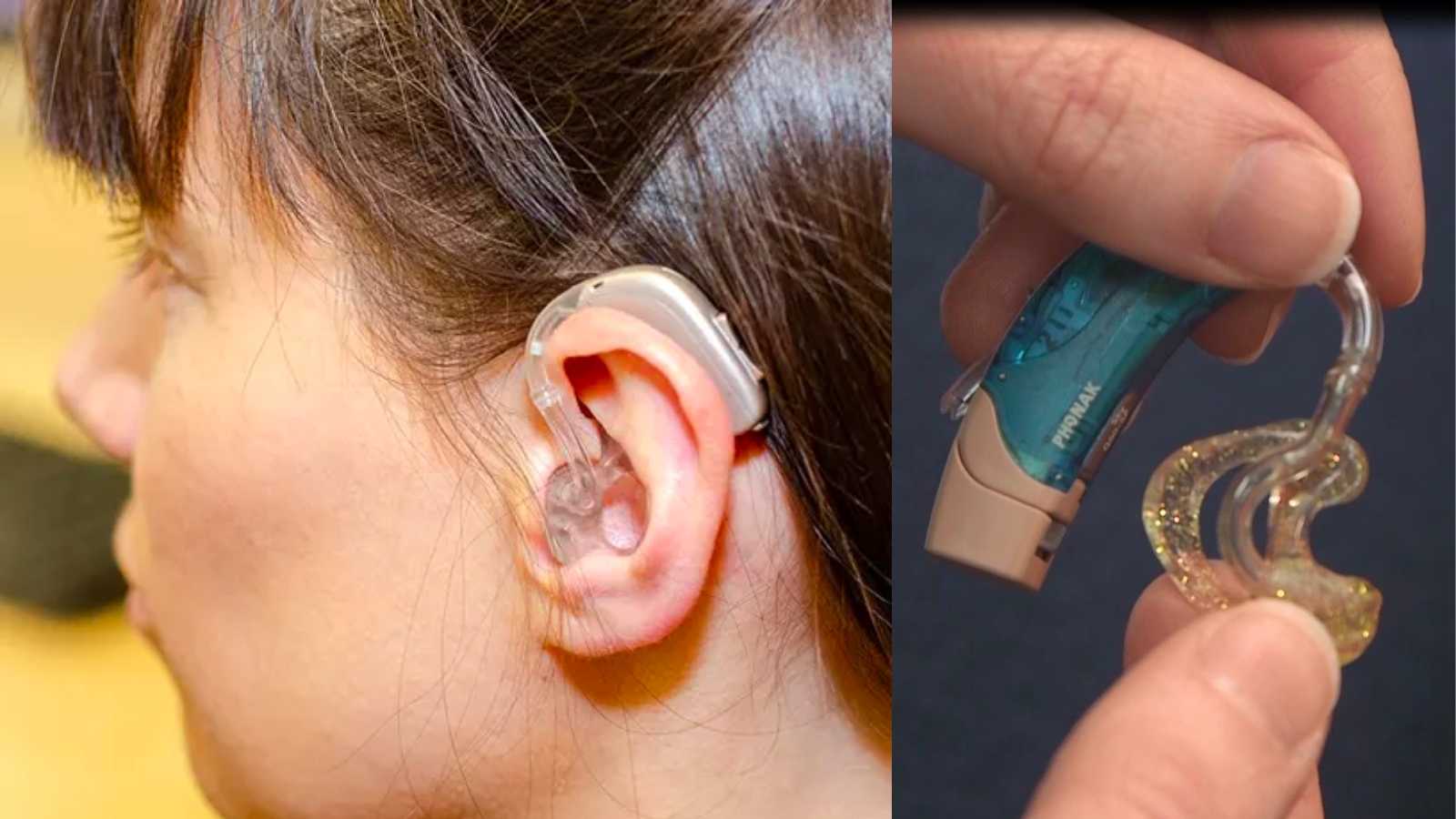 everything-you-need-to-know-about-hearing-aid-earmolds-vs-open-fit-domes