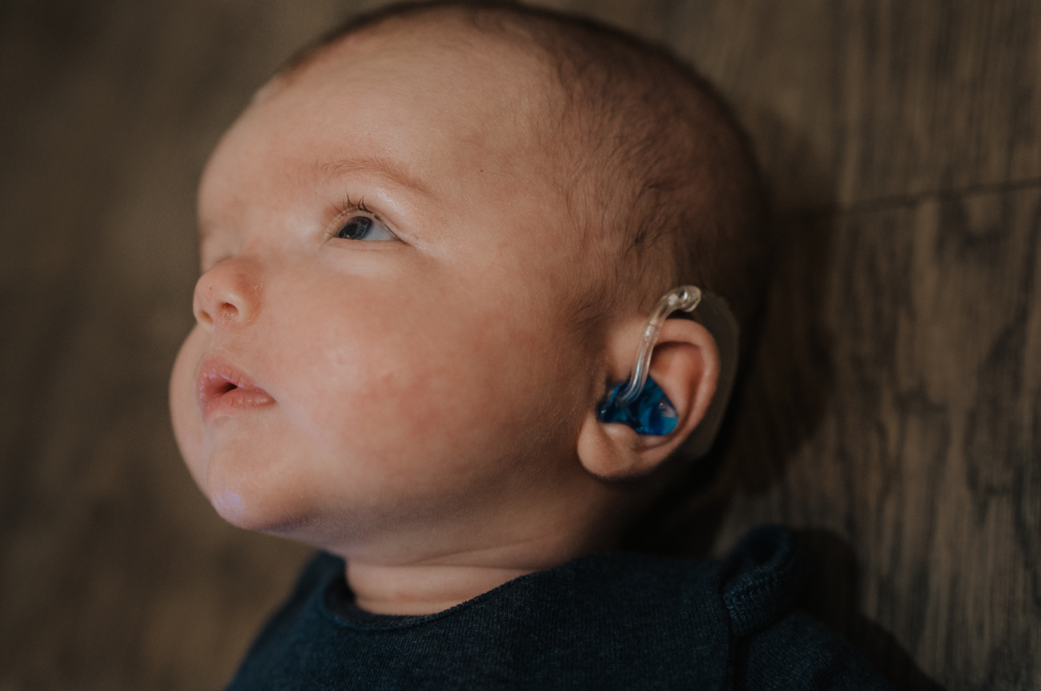 Cochlear Implants Baby - Cooper Leipholtz